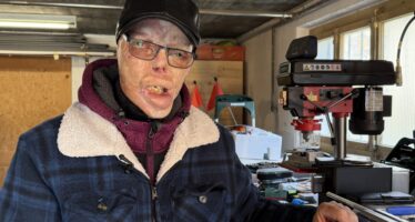 Brandopfer Marcel Mathis macht Mut: Vor 21 Jahren hat er bei einem Wohnungsbrand schwerste Verbrennungen erlitten. Jetzt will der 57-Jährige den Brandopfern von Crans-Montana Mut machen.