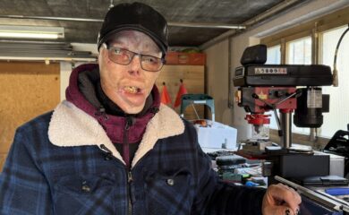 Brandopfer Marcel Mathis macht Mut: Vor 21 Jahren hat er bei einem Wohnungsbrand schwerste Verbrennungen erlitten. Jetzt will der 57-Jährige den Brandopfern von Crans-Montana Mut machen.