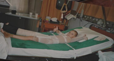 Grands brûlés: «Il faut faire le deuil de ce que l’on était, se construire une nouvelle identité»