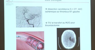 Neuroréadaptation: se relever après une lésion cérébrale