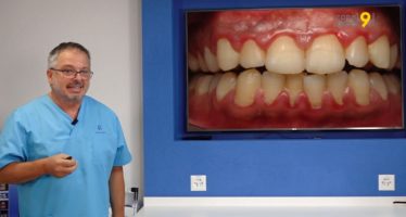 L’astuce dentaire – Consultation 3: C’est quoi la parodontite?